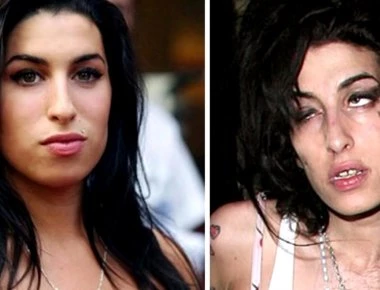 Δέκα διάσημοι που μεταμορφώθηκαν σε τέρατα μετά την χρήση ναρκωτικών (βίντεο)